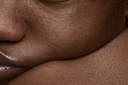 INSCRIÇÕES ABERTAS PARA O PRIMEIRO PRÊMIO L’ORÉAL DERMATOLOGIA MAIS INCLUSIVA